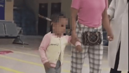 3岁女童头上插刀淡定就医，公安介入！受伤原因是……