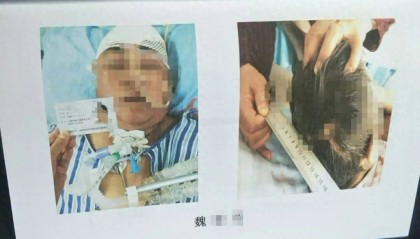 目睹母亲过马路被车撞，27岁女子受惊吓5天后身亡