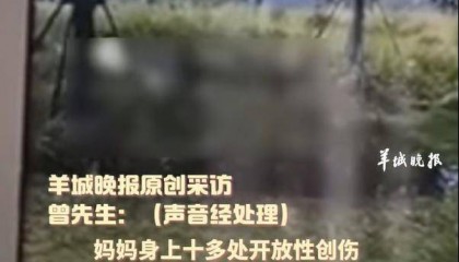 热闻|母女公园散步遭四条大型犬撕咬！家属：狗主人以没钱为由，至今未露面，治疗费用也未偿清