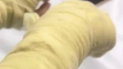 湖南一女主播被伪装的包裹炸伤，永州公安：正在核实具体情况