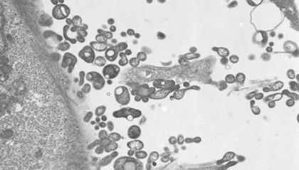 俄罗斯出现“新病毒感染”？调查结果公布